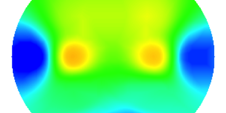 Childs-Brain-in-Orphanage